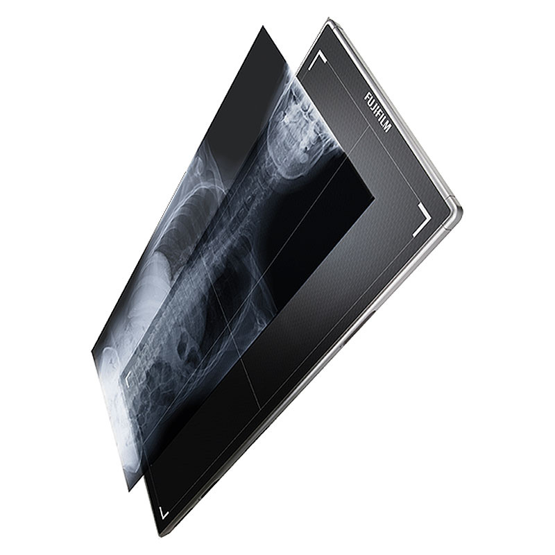 Fujifilm FDR D-EVO III G80i 17 by 32 inch long-length detector displaying a full-spine radiograph