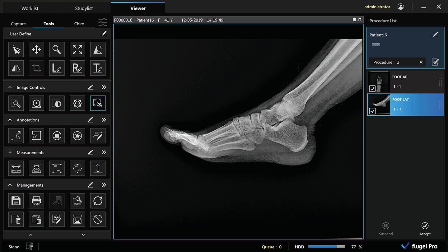 Xmaru Pro acquisition monitors showing weight-bearing foot studies on a Rayence XCel room